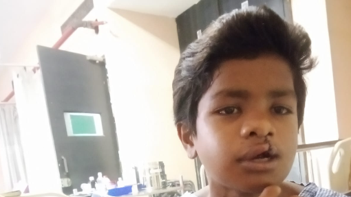 RBSK Chiranjeevi Team: जन्मजात बीमारी से जूझ रहे बच्चे को मिला नया जीवन, सरकार ने उठाया पूरा खर्च